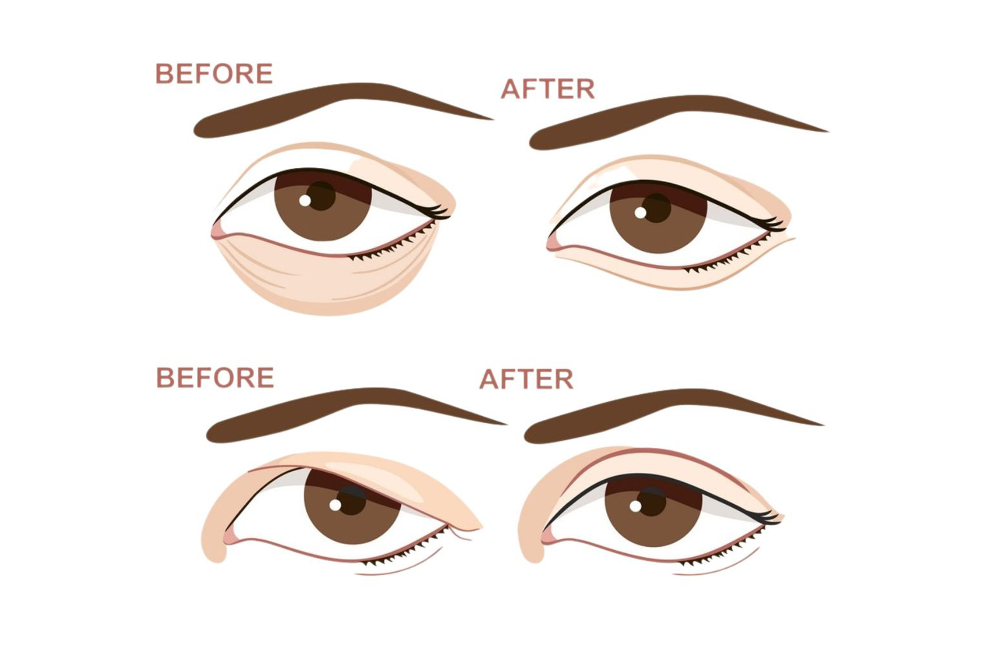 Cosmetic & Plastic Surgery: Eyes