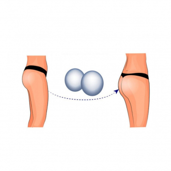 Dr. Ercan Demiray Cosmetic Surgery Clinique - Buttocks Augmentation (Implant) 