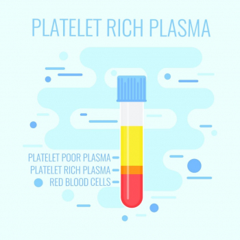 EsteBoss - PlateletRich Plasma (PRP) Injections 