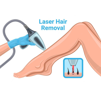 De-Klinika - Laser Hair Removal: Whole Legs 